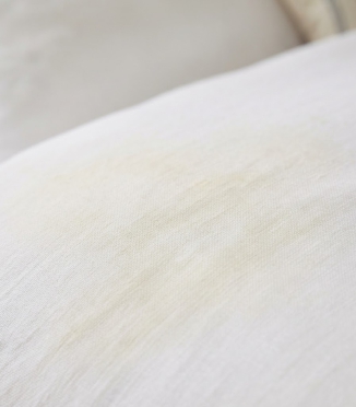 Why does white bedding turn yellow and how can you prevent it?