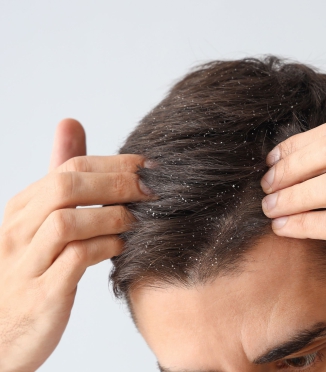 Why do you get dandruff — and is your pillowcase really to blame?